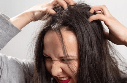 11 Cara Menghilangkan Ketombe yang Membandel dengan Mudah